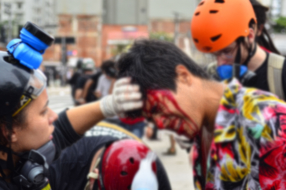 Manifestante ferido na cabeça pela PM em São Paulo. 13 de janeiro de 2016. | ©EBC